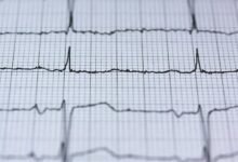 catalyst pulse start 8882060974